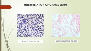INTERPRETATION OF GRAMS STAIN
GRAM POSITIVE COCCI GRAM NEGATIVE COCCI
 