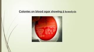 Colonies on blood agar showing β hemolysis
 