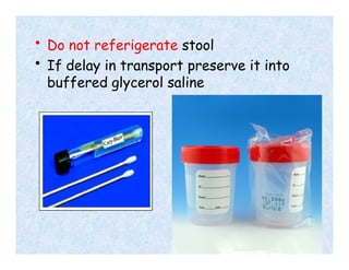 • Do not referigerate stool
• If delay in transport preserve it into
buffered glycerol saline
 