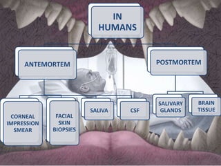 Laboratory diagnoses of RABIES | PPTX