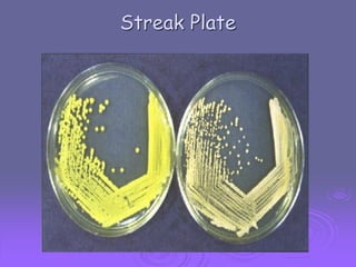 Streak Plate

 