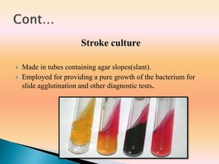 Stroke culture
 Made in tubes containing agar slopes(slant).
 Employed for providing a pure growth of the bacterium for
slide agglutination and other diagnostic tests.
 