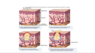 Contiguous Wound Microbiology, Wound infection.pptx