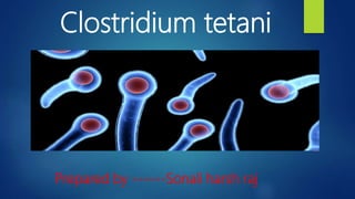 Clostridium tetani
Prepared by ------Sonali harsh raj
 