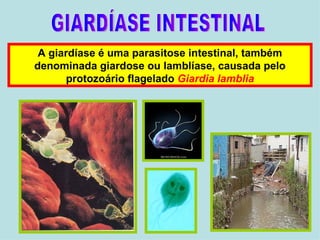 GIARDÍASE INTESTINAL A giardíase é uma parasitose intestinal, também denominada giardose ou lamblíase, causada pelo protozoário flagelado  Giardia   lamblia 
