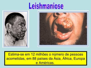 Leishmaniose Estima-se em 12 milhões o número de pessoas acometidas, em 88 países da Ásia, África, Europa e Américas.   
