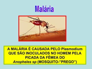 A MALÁRIA É CAUSADA PELO Plasmodium QUE SÃO INOCULADOS NO HOMEM PELA PICADA DA FÊMEA DO Anopheles sp  (MOSQUITO-”PREGO”) Malária 