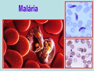 Malária 