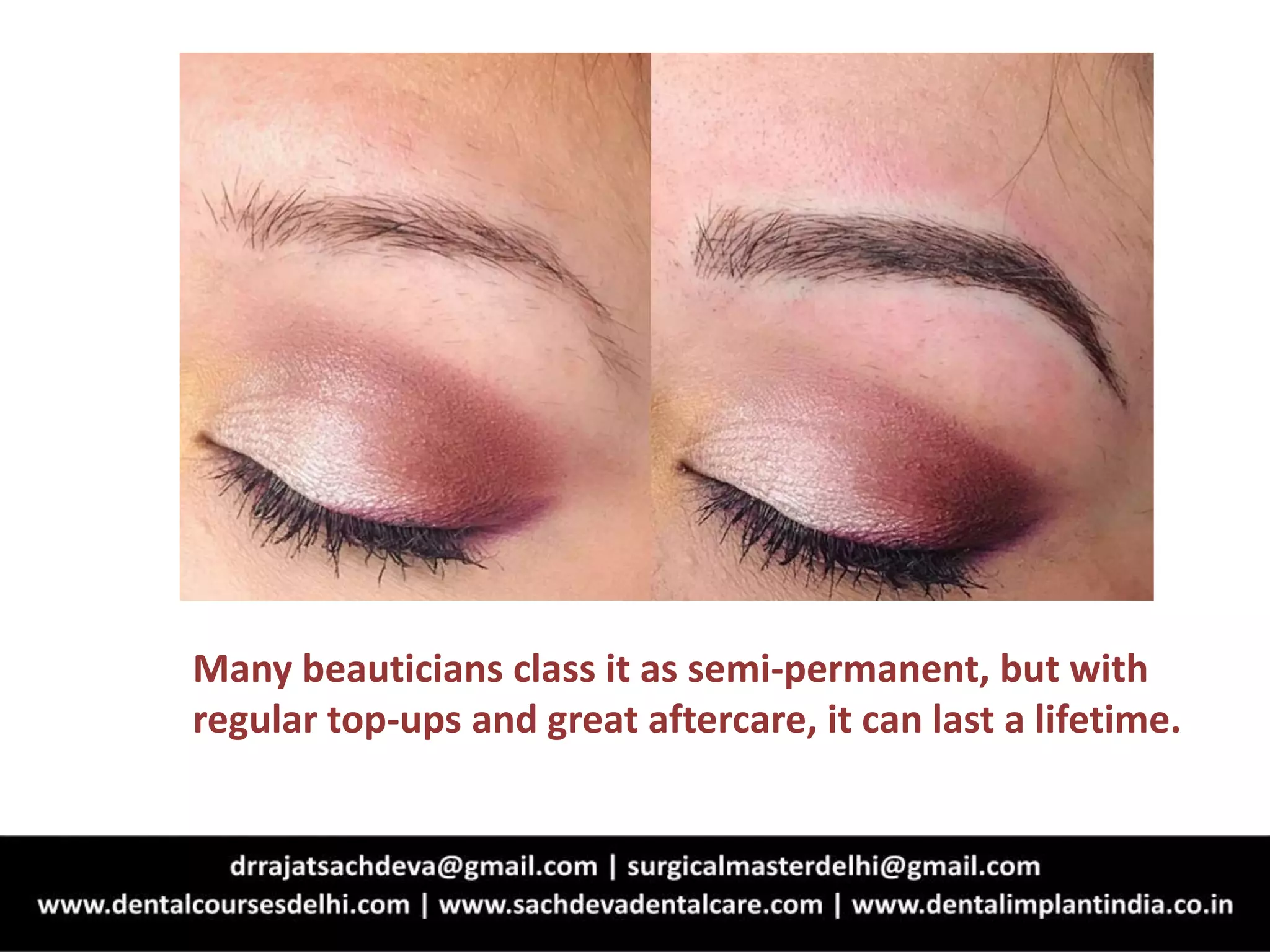 Many beauticians class it as semi-permanent, but with
regular top-ups and great aftercare, it can last a lifetime.
 