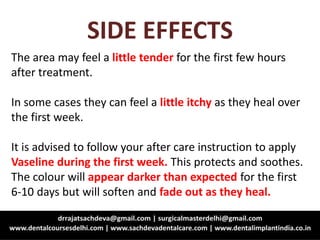 SIDE EFFECTS
The area may feel a little tender for the first few hours
after treatment.
In some cases they can feel a little itchy as they heal over
the first week.
It is advised to follow your after care instruction to apply
Vaseline during the first week. This protects and soothes.
The colour will appear darker than expected for the first
6-10 days but will soften and fade out as they heal.
 