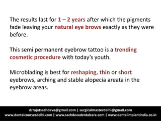 The results last for 1 – 2 years after which the pigments
fade leaving your natural eye brows exactly as they were
before.
This semi permanent eyebrow tattoo is a trending
cosmetic procedure with today’s youth.
Microblading is best for reshaping, thin or short
eyebrows, arching and stable alopecia areata in the
eyebrow areas.
 