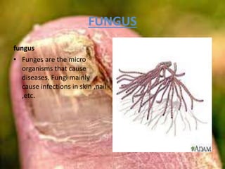 FUNGUS
fungus
• Funges are the micro
organisms that cause
diseases. Fungi mainly
cause infections in skin ,nail
,etc.
