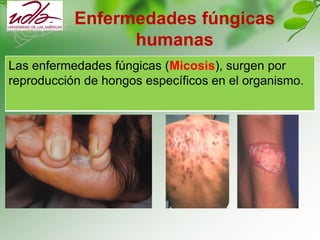 Enfermedades fúngicas
humanas
Las enfermedades fúngicas (Micosis), surgen por
reproducción de hongos específicos en el organismo.
 