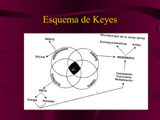 Esquema de Keyes
 
