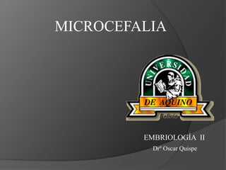 MICROCEFALIA
EMBRIOLOGÍA II
Drº Oscar Quispe
 