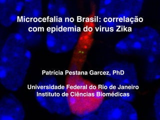 Patrícia Pestana Garcez, PhD!
!
Universidade Federal do Rio de Janeiro!
Instituto de Ciências Biomédicas!
!
Microcefalia no Brasil: correlação
com epidemia do virus Zika
 