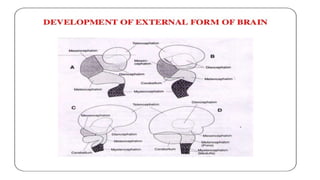 differentials of microcephaly in children population | PPTX