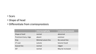• Scars
• Shape of head
• Differentiate from craniosynostosis
microcephaly craniosynostosis
Shape of skull normal abnormal
Prominent bony ridge absent common
Xray Minimal suture line No sutural line
CT scan sutures Sutures fused
Sutural line normal ridged
ICP normal May be increased
 