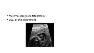 • Maternal serum alfa fetoprotein
• USG- BPD measurement
 