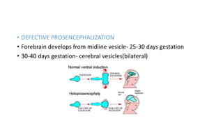 • DEFECTIVE PROSENCEPHALIZATION
• Forebrain develops from midline vesicle- 25-30 days gestation
• 30-40 days gestation- cerebral vesicles(bilateral)
 
