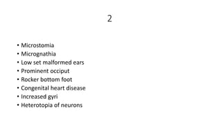 2
• Microstomia
• Micrognathia
• Low set malformed ears
• Prominent occiput
• Rocker bottom foot
• Congenital heart disease
• Increased gyri
• Heterotopia of neurons
 