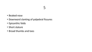 5
• Beaked nose
• Downward slanting of palpebral fissures
• Epicanthic folds
• Short stature
• Broad thumbs and toes
 