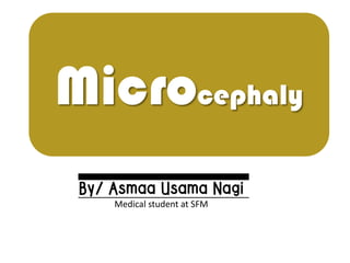 Microcephaly
By/ Asmaa Usama NagiMedical student at SFM
 