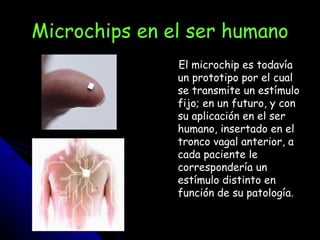 Microchips en el ser humano El microchip es todavía un prototipo por el cual se transmite un estímulo fijo; en un futuro, y con su aplicación en el ser humano, insertado en el tronco vagal anterior, a cada paciente le correspondería un estímulo distinto en función de su patología.  
