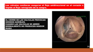 Las válvulas cardiacas aseguran el flujo unidireccional en el corazón e
impide el flujo retrogrado de la sangre.
EL CIERRE DE LAS VALVULAS PROVOCAN
SONIDOS AUDIBLES.
CUANDO LAS VALVULAS SE ABREN
NORMALMENTE NO PRODUCEN NINGUN
RUIDO
 