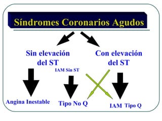Síndromes Coronarios Agudos


       Sin elevación            Con elevación
          del ST                   del ST
                   IAM Sin ST




Angina Inestable    Tipo No Q      IAM Tipo Q
 