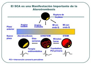 El SCA es una Manifestación Importante de la
                  Aterotrombosis
                                              Ruptura de
                                               la placa


               Angina          Angina        MI sin        MI con
Plazo          estable         inestable     onda Q        onda Q
anterior


Nuevo      Aterotrombosis      UI/NSTEMI                   STEMI
plazo                   Días-                 Minutos-
                        semanas               horas


                         Terapia            Trombólisis
                         antitrombótica     PCI primaria



  PCI = Intervención coronaria percutánea
 