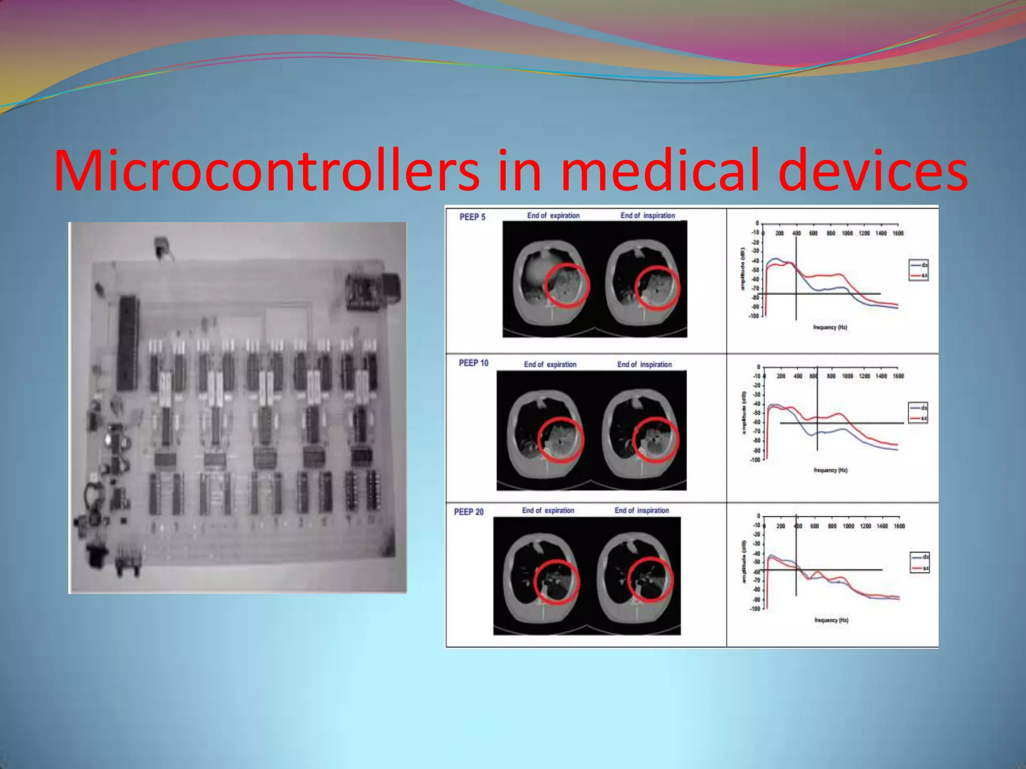 Microcontrollers in medical devices