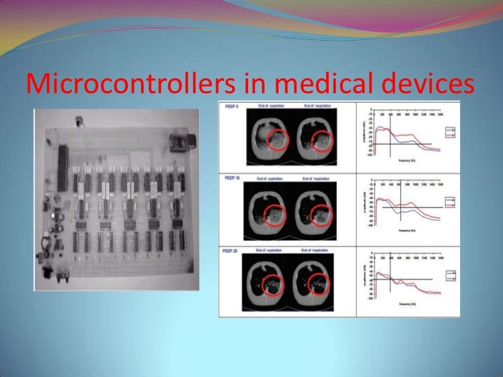 Microcontroller presentation