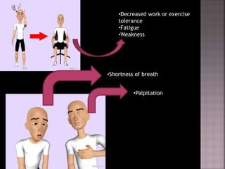 •Shortness of breath
•Palpitation
•Decreased work or exercise
tolerance
•Fatigue
•Weakness
Dr. Monika Nema
 