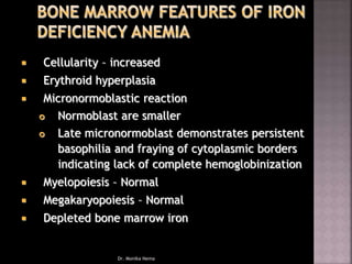 Cellularity – increased
 Erythroid hyperplasia
 Micronormoblastic reaction
 Normoblast are smaller
 Late micronormoblast demonstrates persistent
basophilia and fraying of cytoplasmic borders
indicating lack of complete hemoglobinization
 Myelopoiesis – Normal
 Megakaryopoiesis – Normal
 Depleted bone marrow iron
Dr. Monika Nema
 