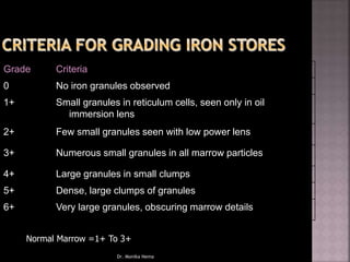 Grade Criteria
0 No iron granules observed
1+ Small granules in reticulum cells, seen only in oil
immersion lens
2+ Few small granules seen with low power lens
3+ Numerous small granules in all marrow particles
4+ Large granules in small clumps
5+ Dense, large clumps of granules
6+ Very large granules, obscuring marrow details
Normal Marrow =1+ To 3+
Dr. Monika Nema
 