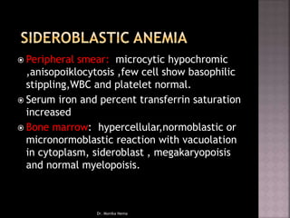  Peripheral smear: microcytic hypochromic
,anisopoiklocytosis ,few cell show basophilic
stippling,WBC and platelet normal.
 Serum iron and percent transferrin saturation
increased
 Bone marrow: hypercellular,normoblastic or
micronormoblastic reaction with vacuolation
in cytoplasm, sideroblast , megakaryopoisis
and normal myelopoisis.
Dr. Monika Nema
 