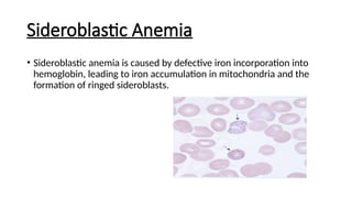 Sideroblastic Anemia
• Sideroblastic anemia is caused by defective iron incorporation into
hemoglobin, leading to iron accumulation in mitochondria and the
formation of ringed sideroblasts.
 