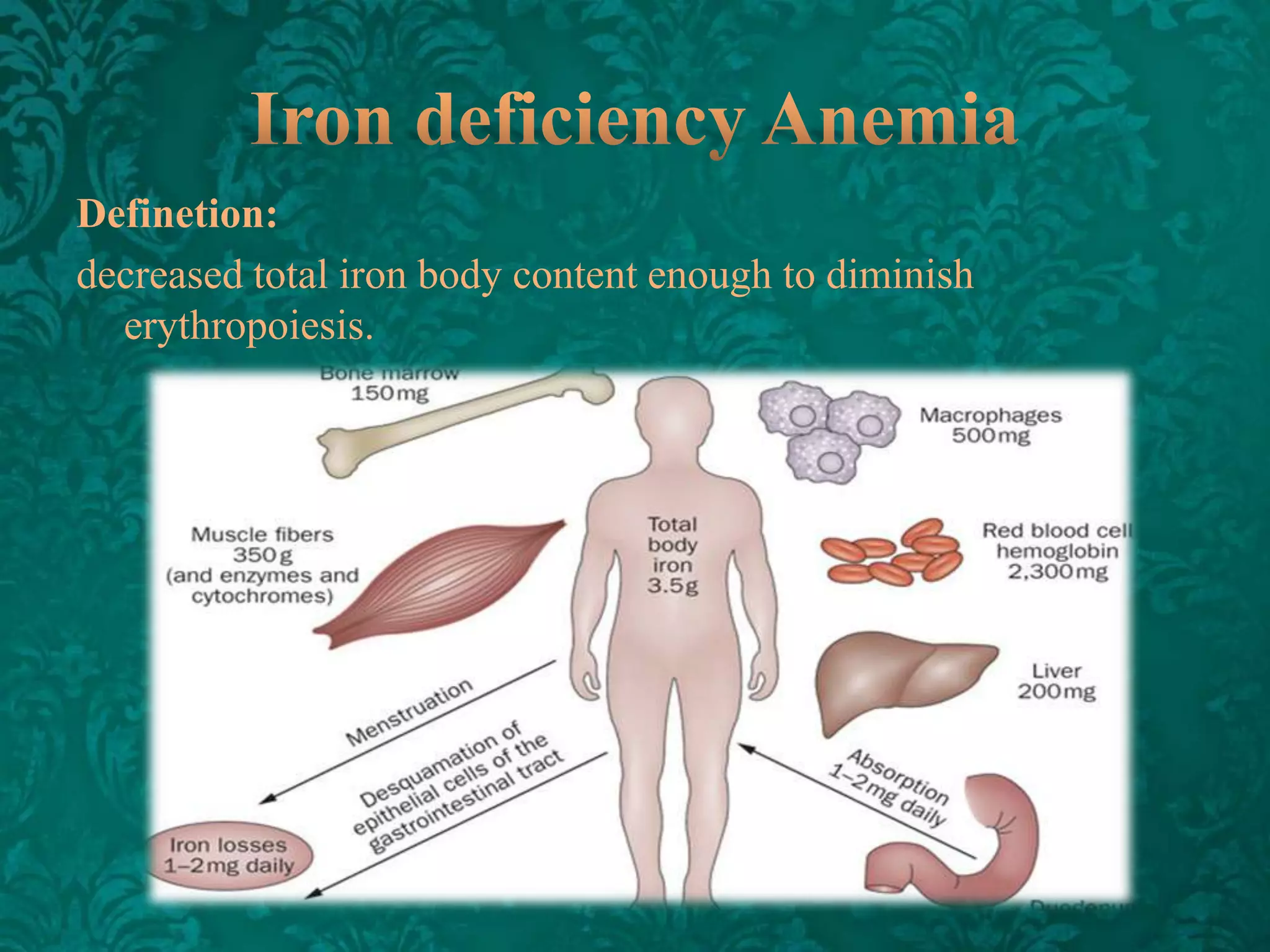 Definetion:
decreased total iron body content enough to diminish
erythropoiesis.

 
