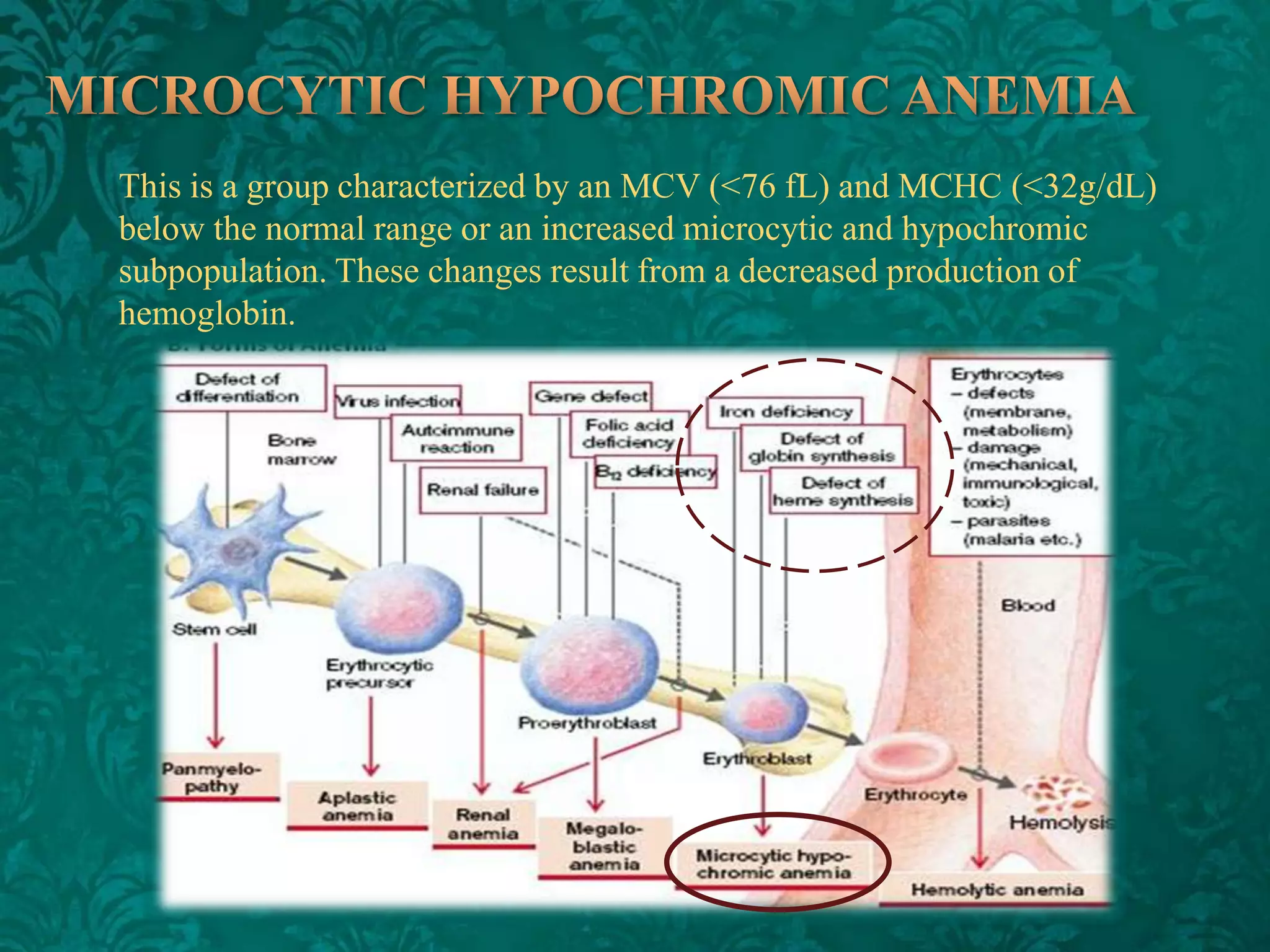 This is a group characterized by an MCV (<76 fL) and MCHC (<32g/dL)
below the normal range or an increased microcytic and hypochromic
subpopulation. These changes result from a decreased production of
hemoglobin.

 