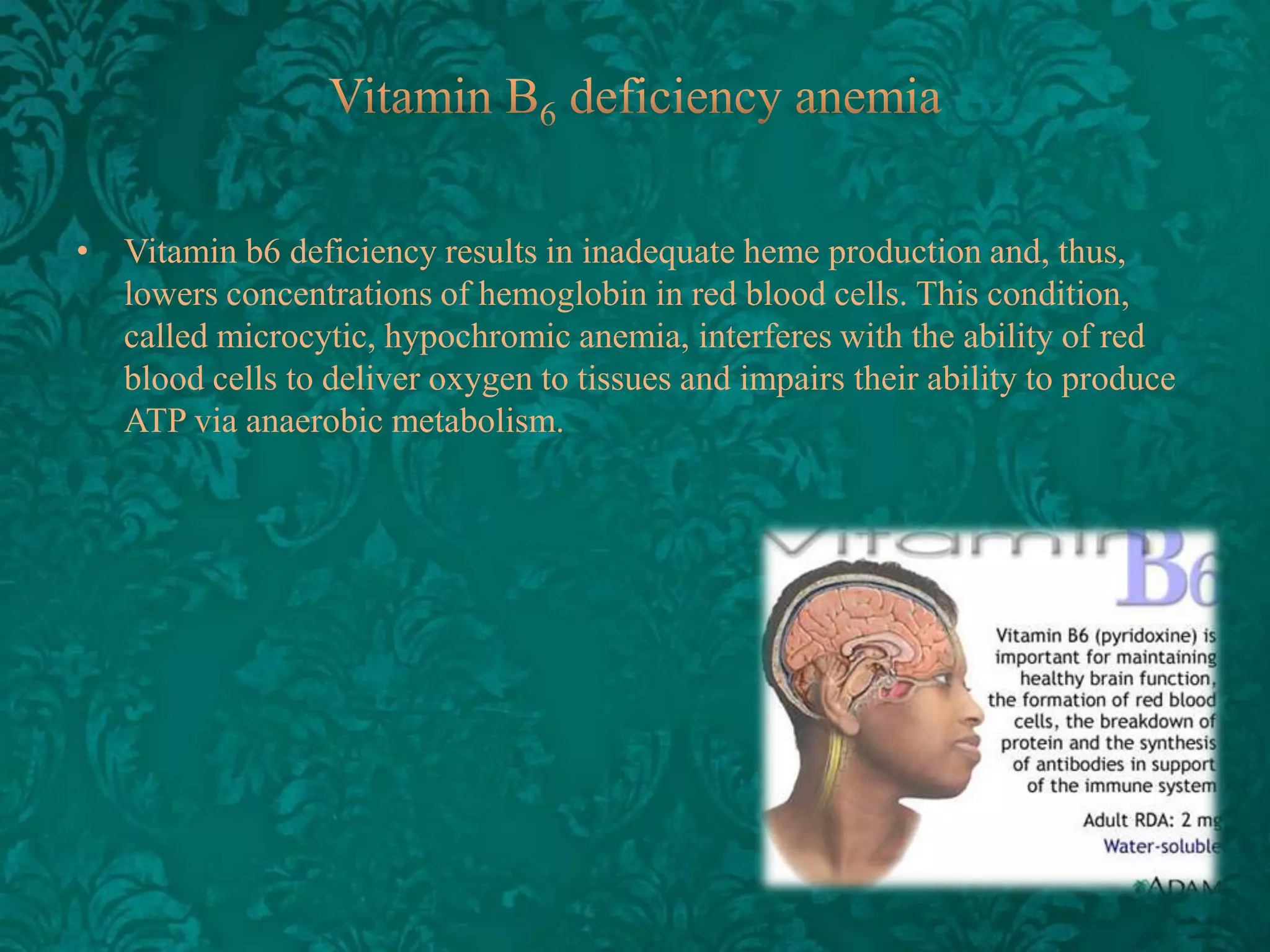 • Vitamin b6 deficiency results in inadequate heme production and, thus,
lowers concentrations of hemoglobin in red blood cells. This condition,
called microcytic, hypochromic anemia, interferes with the ability of red
blood cells to deliver oxygen to tissues and impairs their ability to produce
ATP via anaerobic metabolism.

 