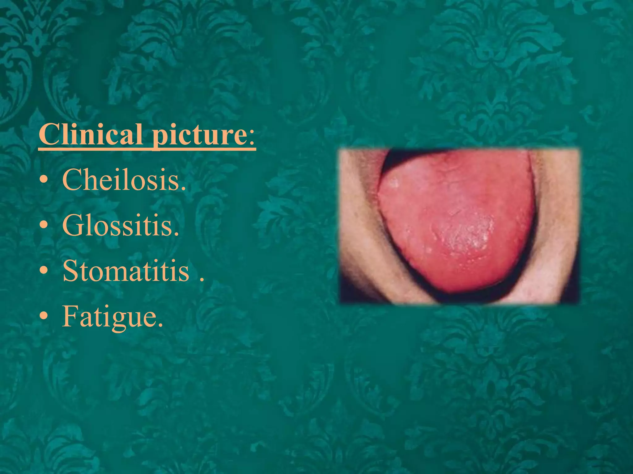 Clinical picture:
• Cheilosis.
• Glossitis.
• Stomatitis .
• Fatigue.

 
