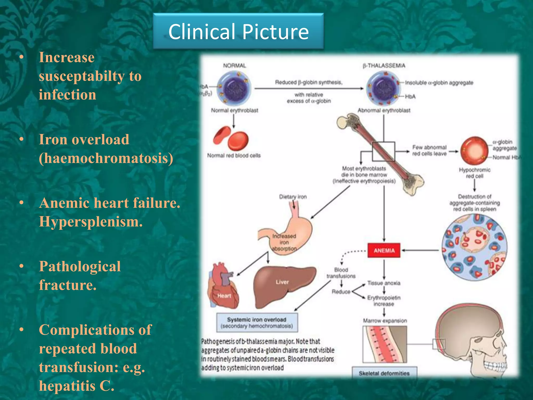 Clinical Picture
• Increase
susceptabilty to
infection

• Iron overload
(haemochromatosis)
• Anemic heart failure.
Hypersplenism.
• Pathological
fracture.
• Complications of
repeated blood
transfusion: e.g.
hepatitis C.

 