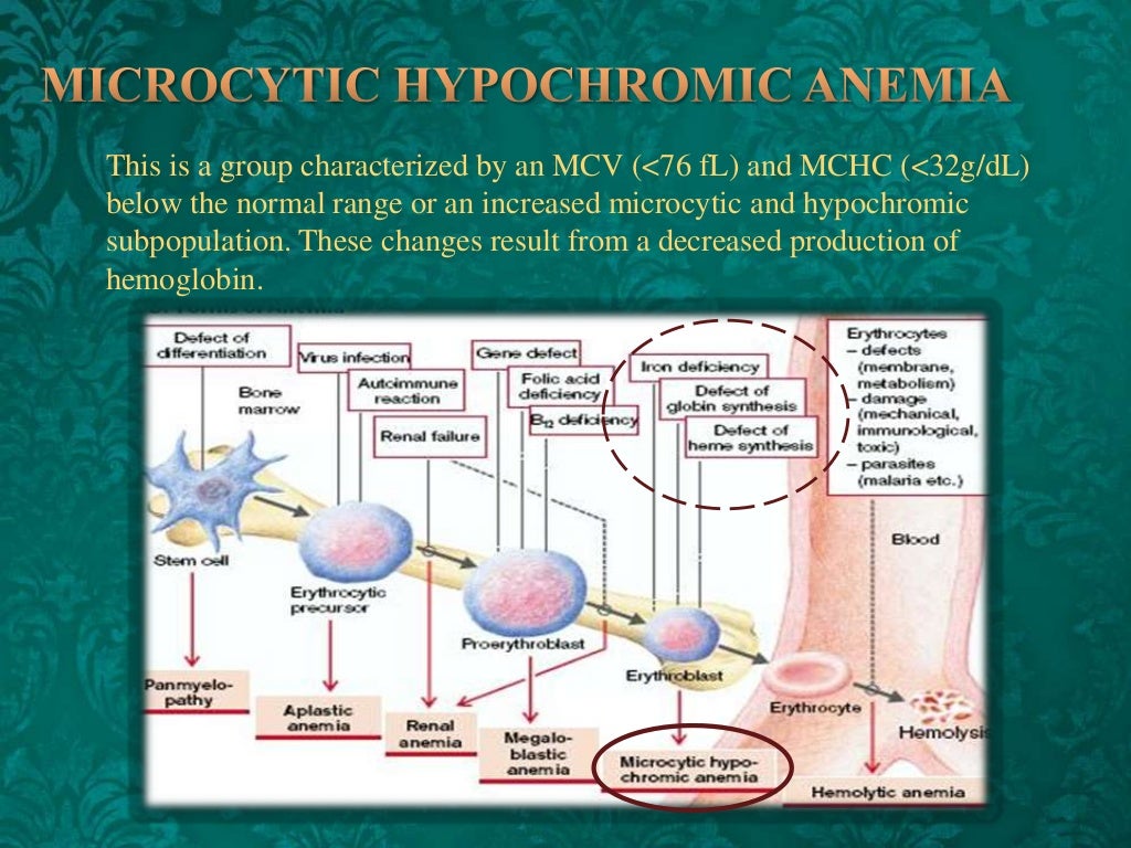 Microcytic hypochromic anemia