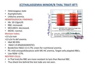 (C)THALASSEMIA MINOR/B THAL TRAIT-BTT:
• Heterozygous state
• Asymptomatic.
• Little/no anemia.
HEMATOLOGICAL FINDINGS:
• Hb: 10-12gm/dl.
• RBC: increased.
• MCV,MCH: decreased.
• MCHC: normal.
Mentzer index:
<13 s/o trait
>13 s/o Fe def anemia.
• HbA 90-93%
• HbA2 3.9-8%(DIAGNOSTIC)
• Borderline HbA2 3.3-3.7%: creen for nutritional anemia.
• PS: mild anisopoikilocytosis with MC-HC anemia, Target cells,stippled RBCs.
• Low RDW <17%.
NESTROF CELLS:
• In Thal trait,the RBC are more resistant to lysis than Normal RBC.
• Thus black line behind the test tube are not seen.
 