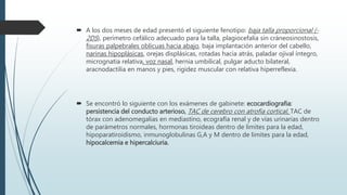  A los dos meses de edad presentó el siguiente fenotipo: baja talla proporcional (-
2DS), perímetro cefálico adecuado para la talla, plagiocefalia sin cráneosinostosis,
fisuras palpebrales oblicuas hacia abajo, baja implantación anterior del cabello,
narinas hipoplásicas, orejas displásicas, rotadas hacia atrás, paladar ojival íntegro,
micrognatia relativa, voz nasal, hernia umbilical, pulgar aducto bilateral,
aracnodactilia en manos y pies, rigidez muscular con relativa hiperreflexia.
 Se encontró lo siguiente con los exámenes de gabinete: ecocardiografia:
persistencia del conducto arterioso, TAC de cerebro con atrofia cortical, TAC de
tórax con adenomegalias en mediastino, ecografía renal y de vías urinarias dentro
de parámetros normales, hormonas tiroideas dentro de limites para la edad,
hipoparatiroidismo, inmunoglobulinas G,A y M dentro de limites para la edad,
hipocalcemia e hipercalciuria.
 