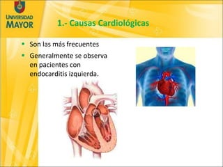 1.- Causas Cardiológicas <ul><li>Son las más frecuentes </li></ul><ul><li>Generalmente se observa en pacientes con endocar...