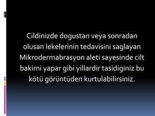 Cildinizde dogustan veya sonradan olusan lekelerinin tedavisini saglayanMikrodermabrasyon aleti sayesinde cilt bakimi yapar gibi yillardirtasidiginiz bu kötü görüntüden kurtulabilirsiniz.