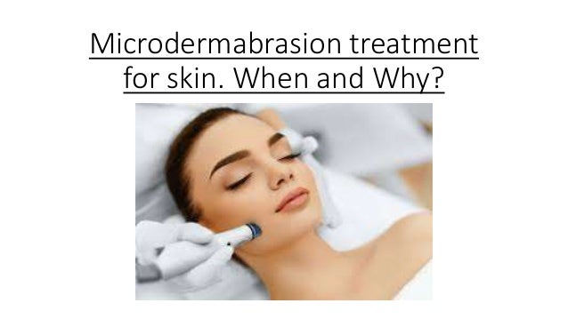 microdermabrasion treatment
