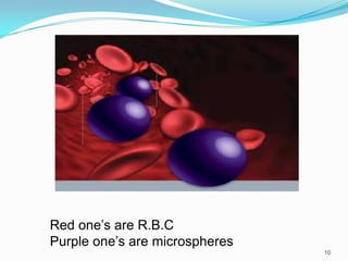 Red one’s are R.B.C
Purple one’s are microspheres
10

 
